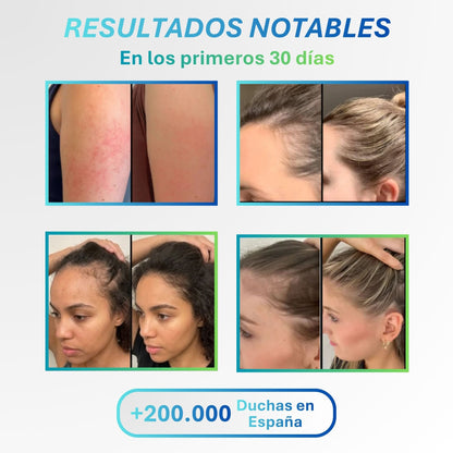Salva Tu Piel, Tu Pelo y Tu Salud con Ecoozonic™